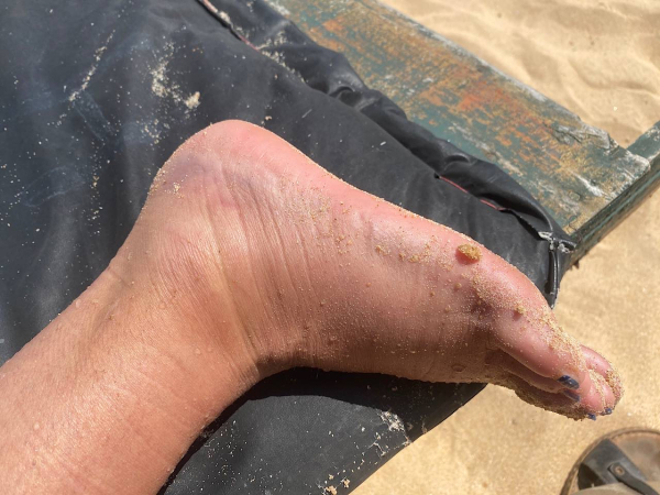 Knöchel mit Meerfarbe 😉